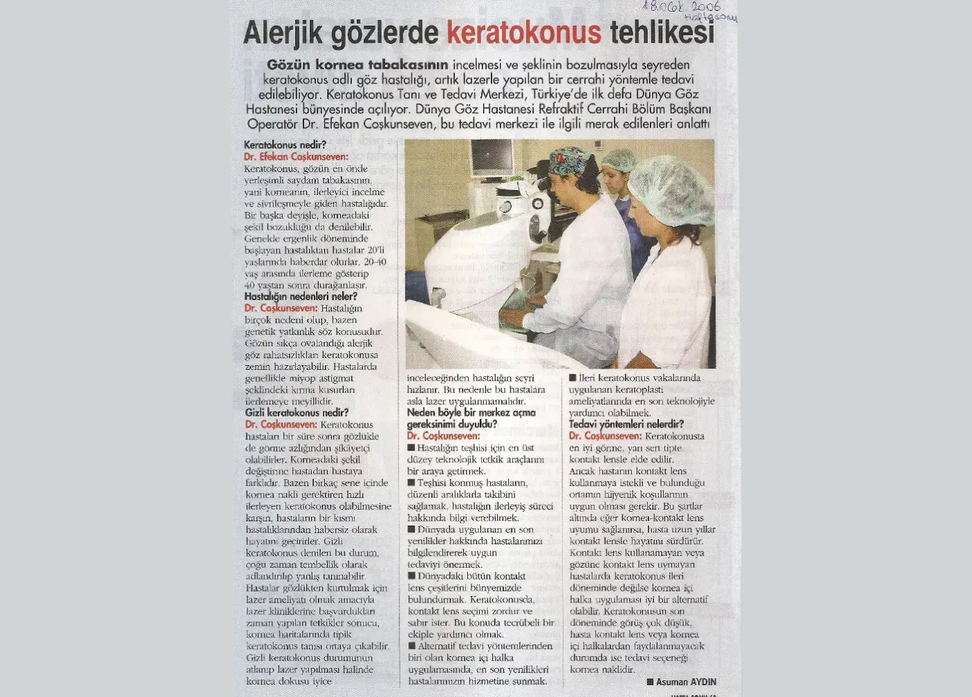 Basın kupürü — keratokonus