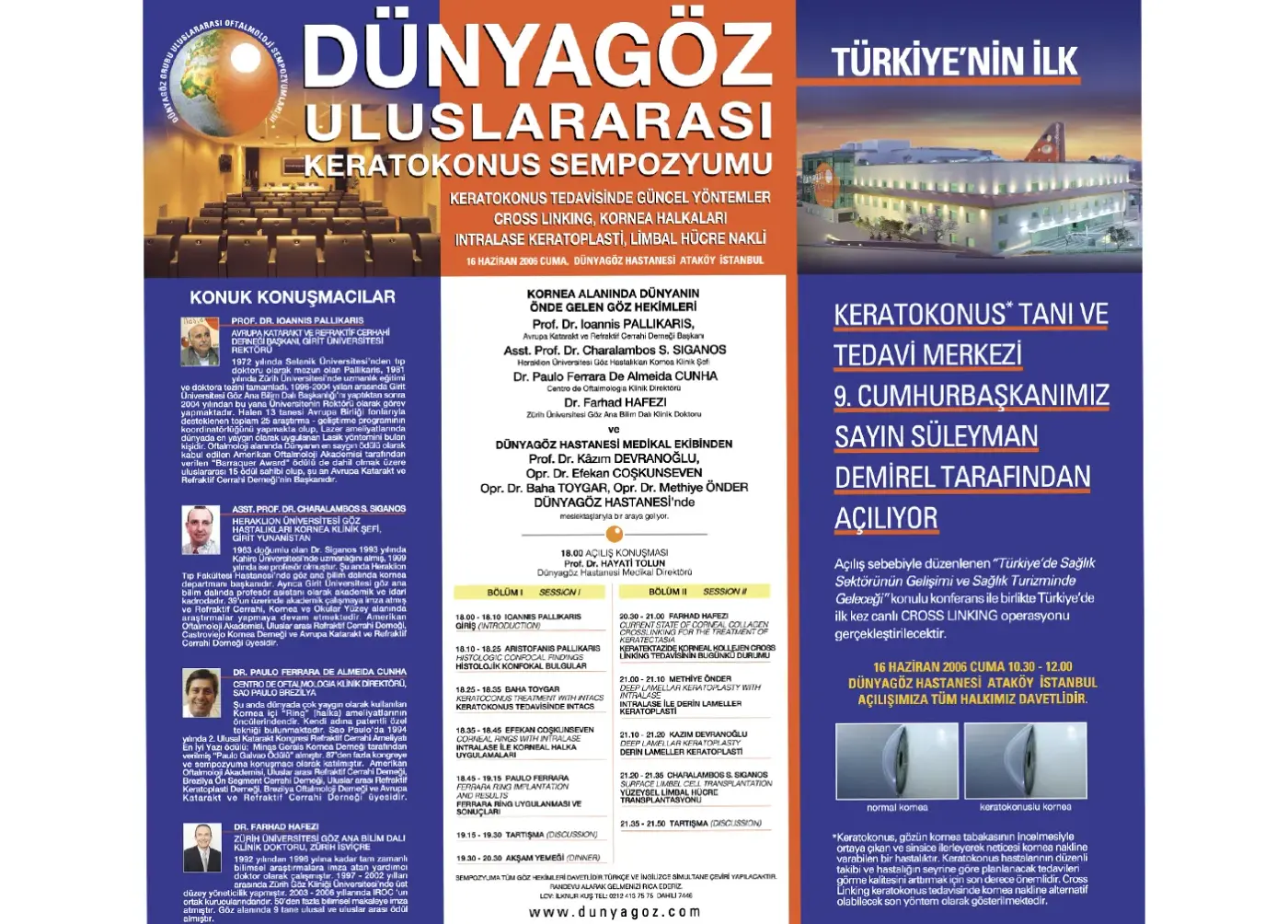 Basın kupürü — keratokonus