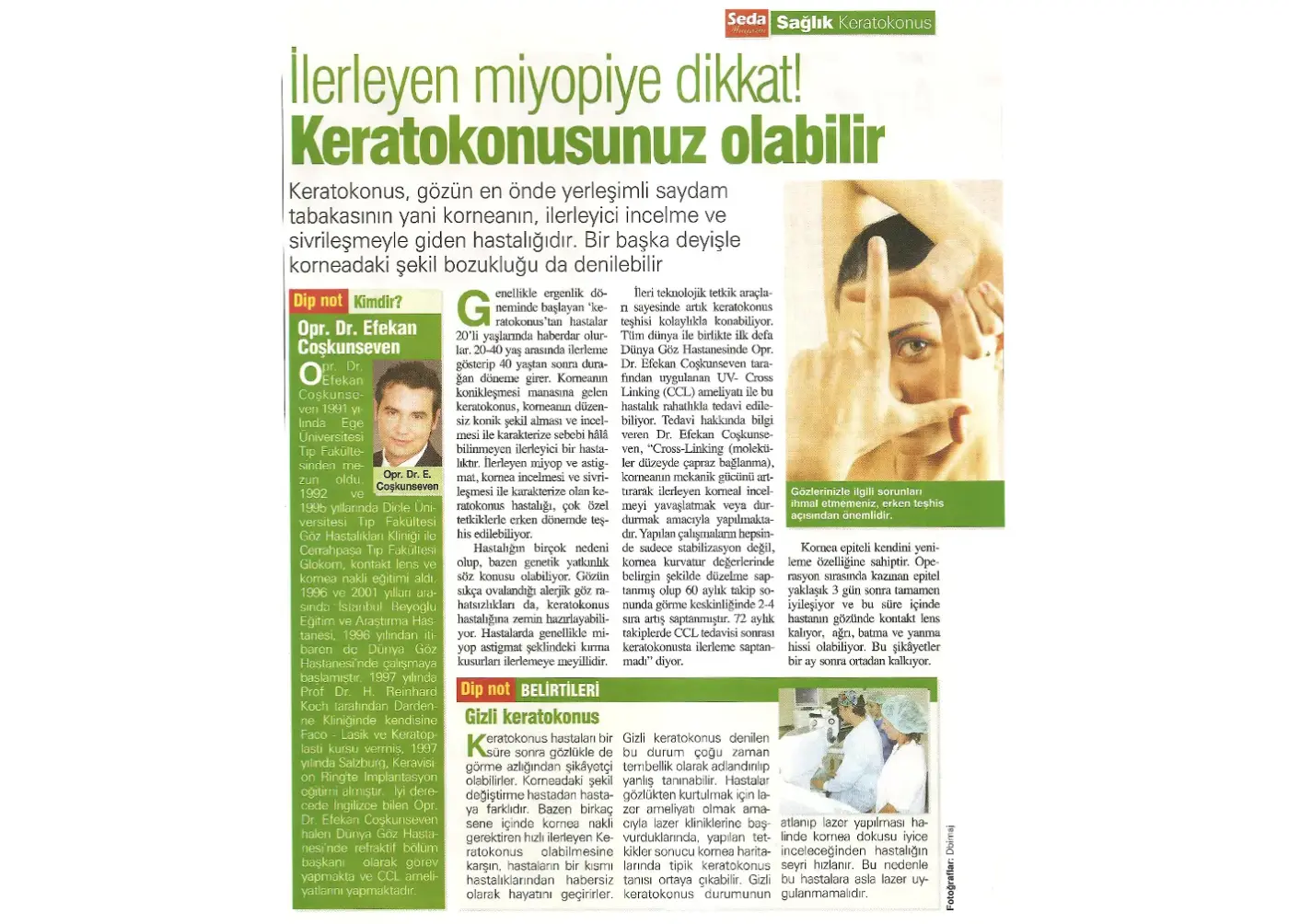 Basın kupürü — keratokonus