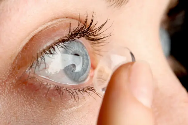 Keratokonusta Lens Neden Gereklidir?