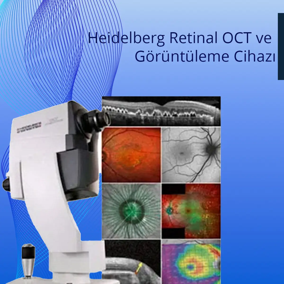 Heidelberg Retinal OCT ve Görüntüleme Cihazı